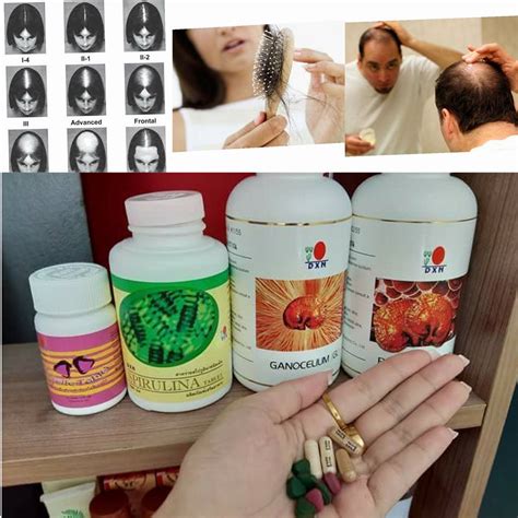 vitamins para sa nalalagas na buhok|6 pinakamahusay na Vitamins para sa control ng buhok pagkahulog.